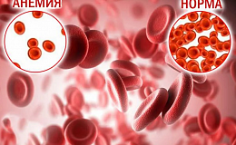 Диагностика анемий Диагностика анемий
